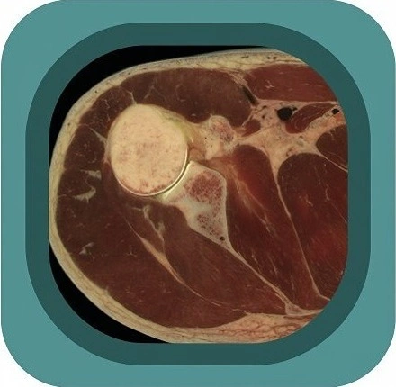 visible body project shoulder anatomy icon